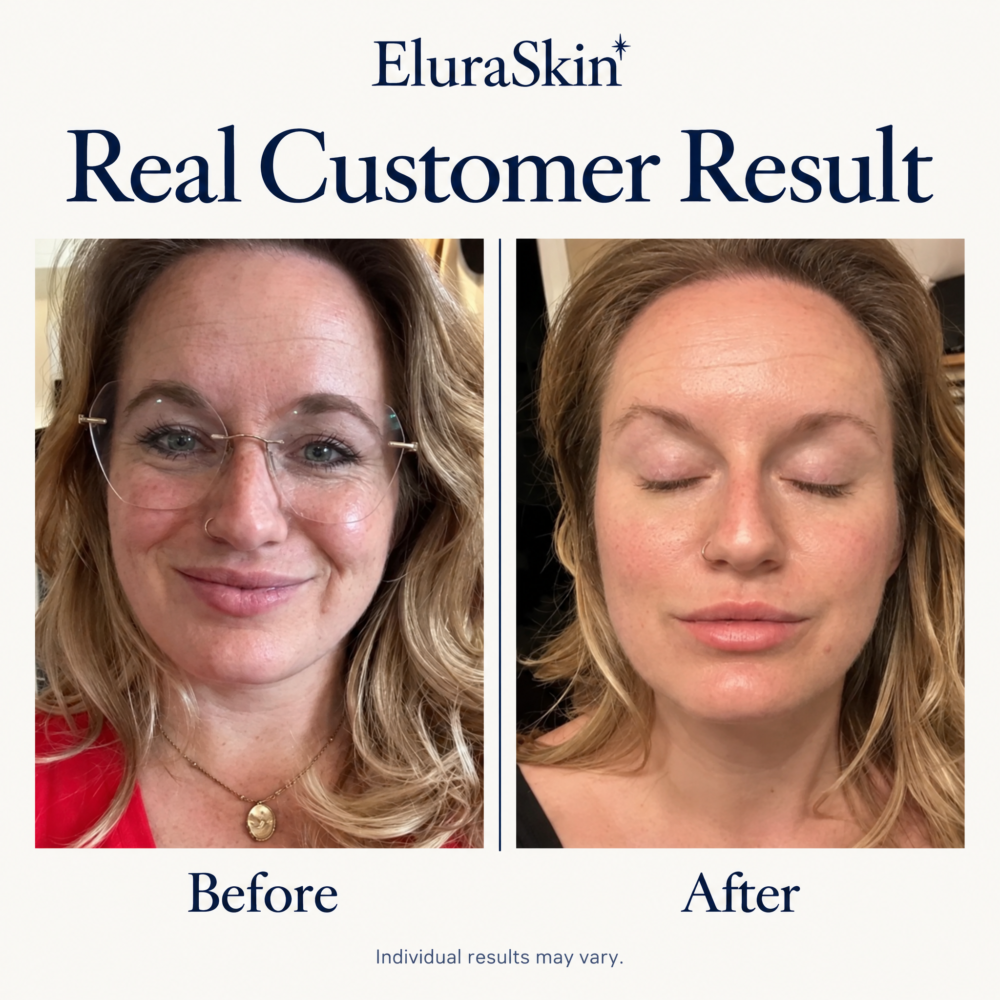 Collagen Glow Up Mask 2.0