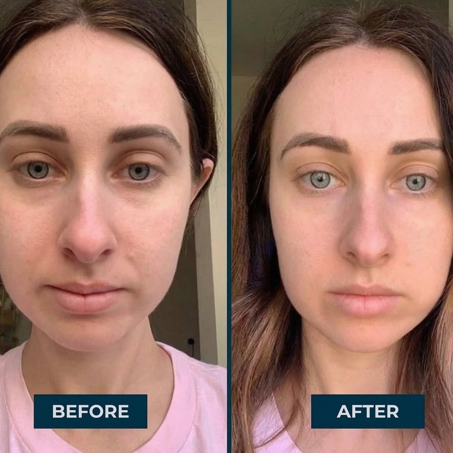 Collagen Eye Patches