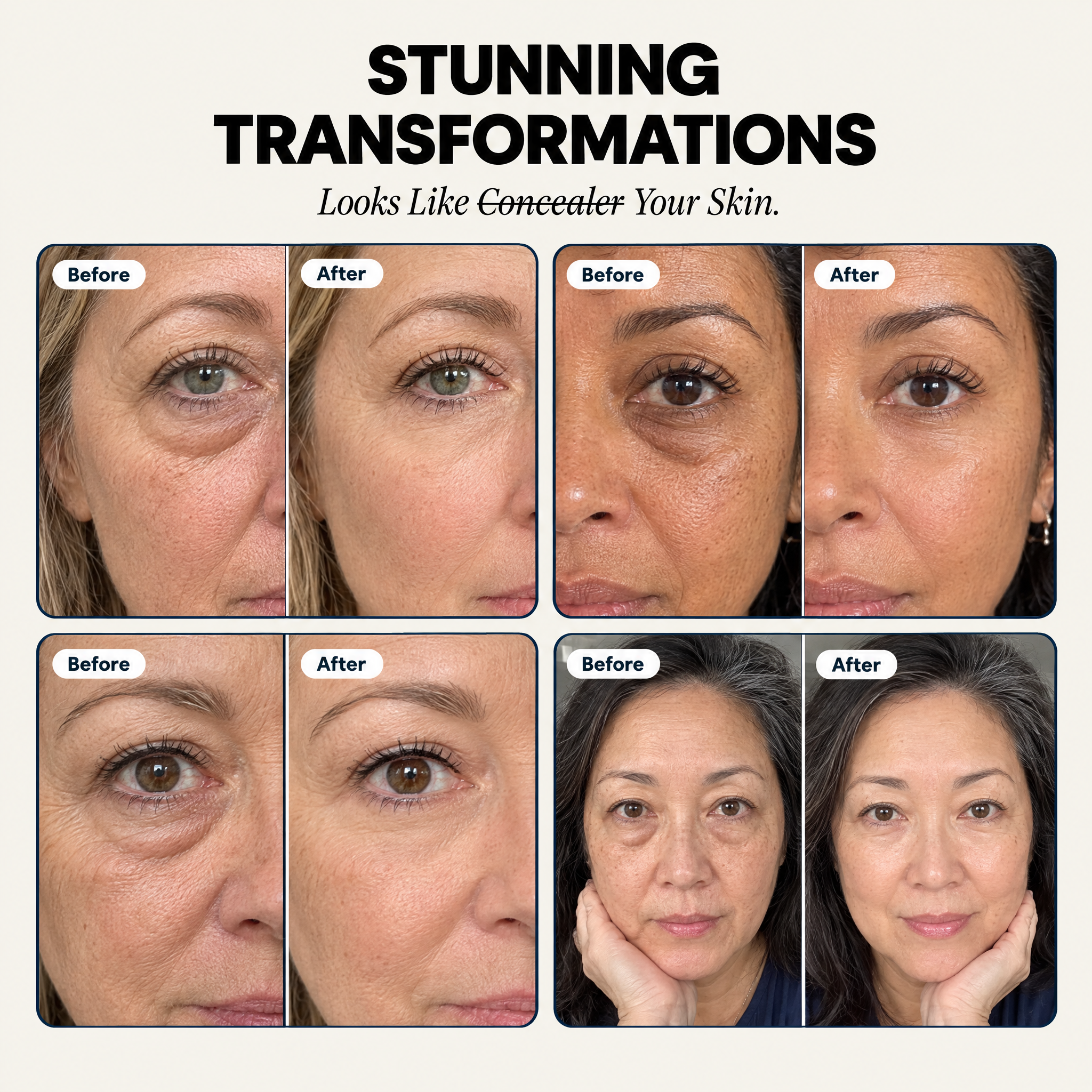 Collagen Eye Patches
