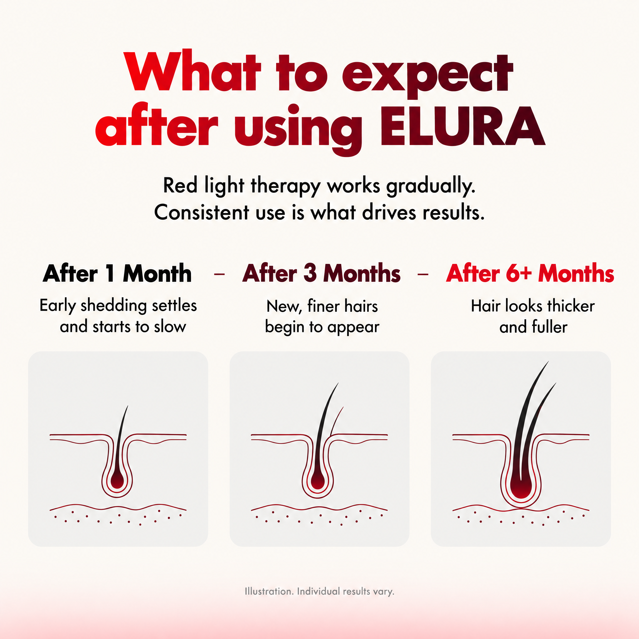 ELURA® 302 Clinical